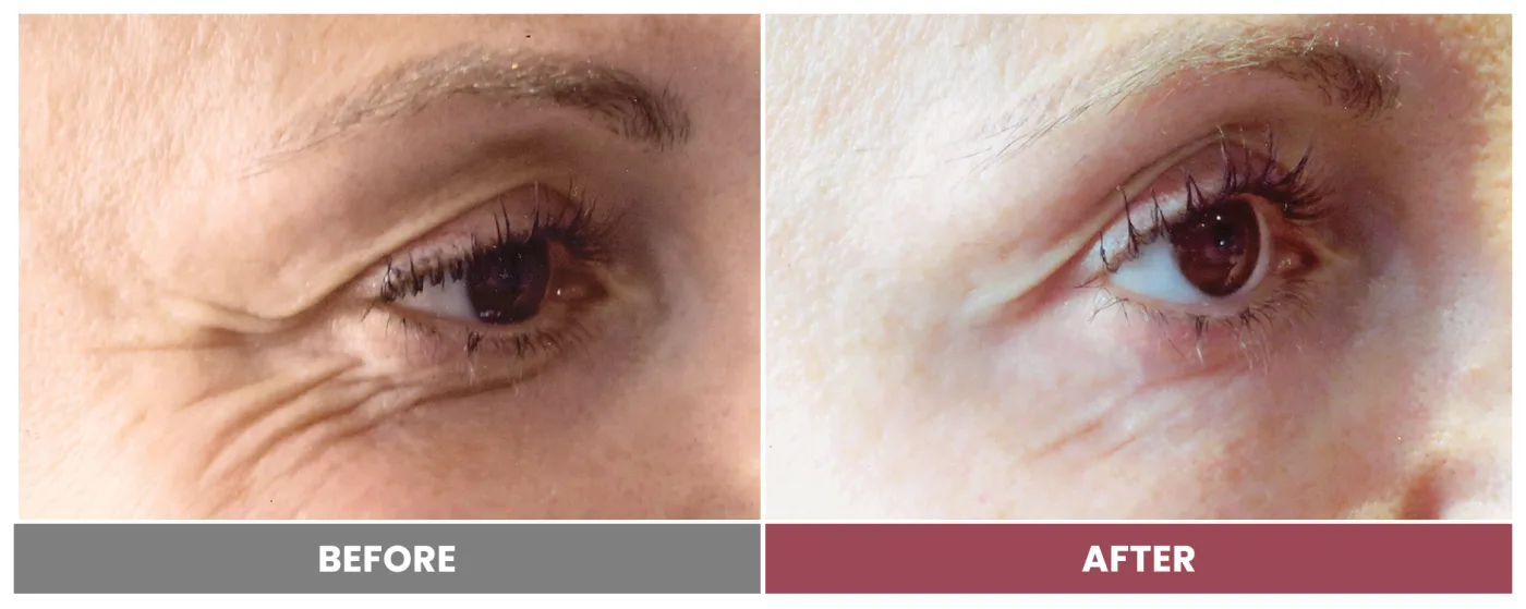 NEUROMODULATORS & DERMAL FILLERS - Case 10
