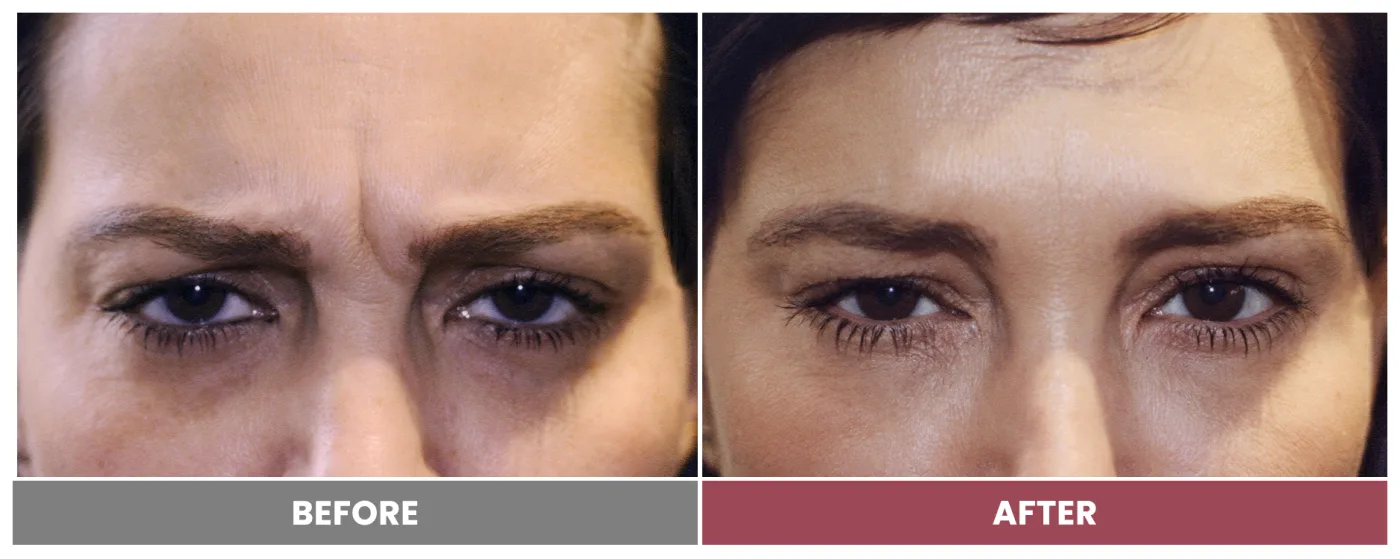 NEUROMODULATORS & DERMAL FILLERS - Case 12