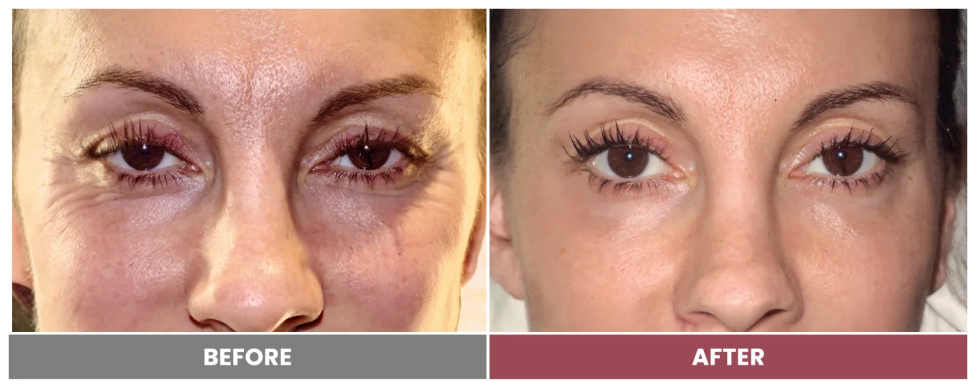 NEUROMODULATORS & DERMAL FILLERS - Case 16