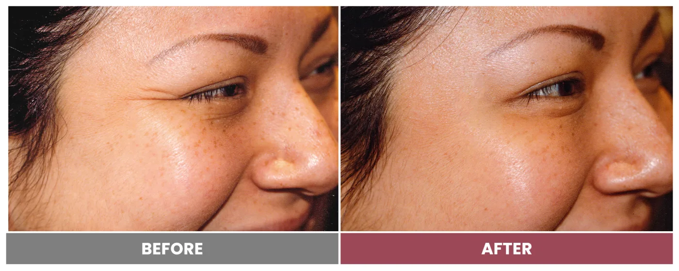 NEUROMODULATORS & DERMAL FILLERS - Case 19