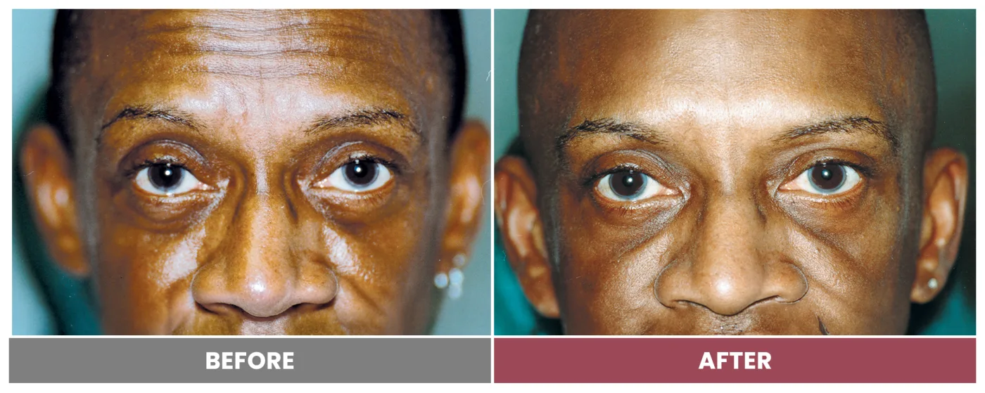 NEUROMODULATORS & DERMAL FILLERS - Case 2