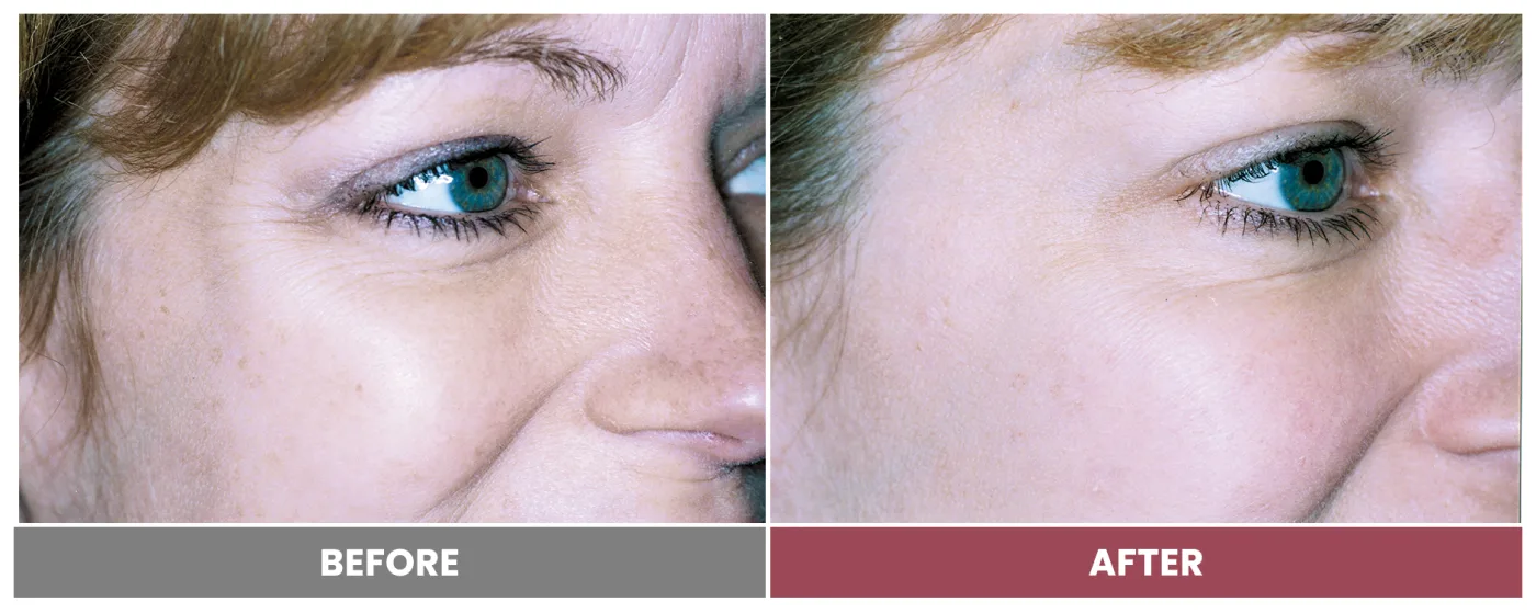 NEUROMODULATORS & DERMAL FILLERS - Case 20