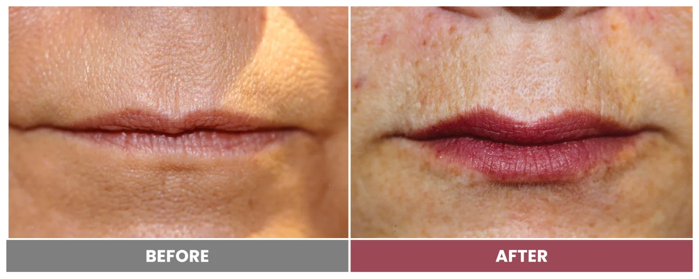 NEUROMODULATORS & DERMAL FILLERS - Case 21