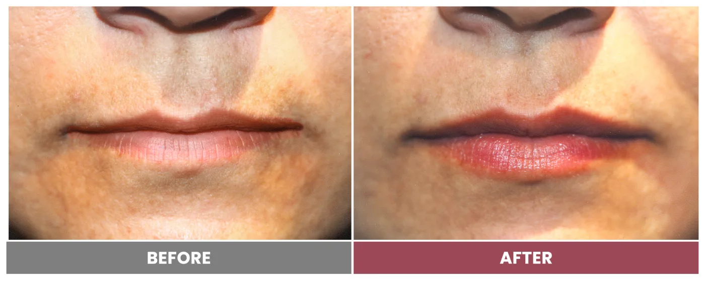 NEUROMODULATORS & DERMAL FILLERS - Case 22