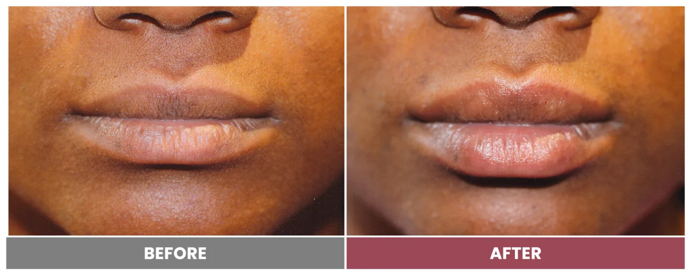 NEUROMODULATORS & DERMAL FILLERS - Case 24