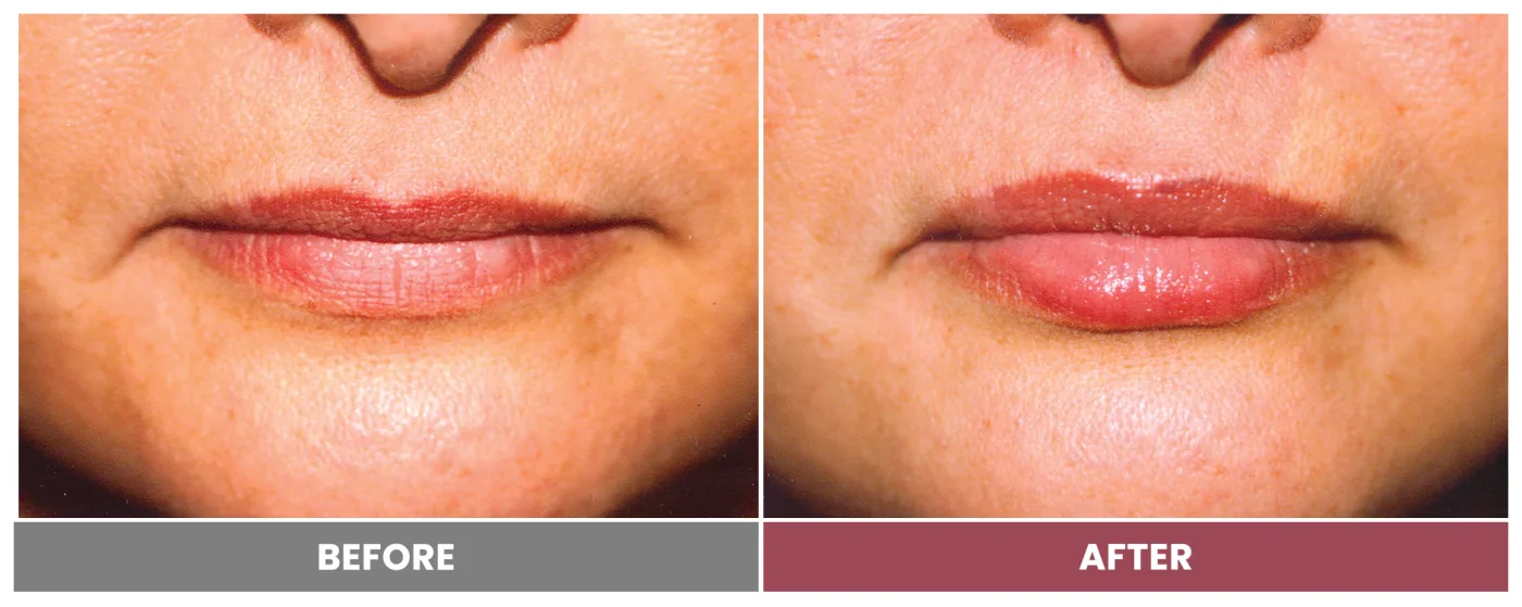 NEUROMODULATORS & DERMAL FILLERS - Case 27
