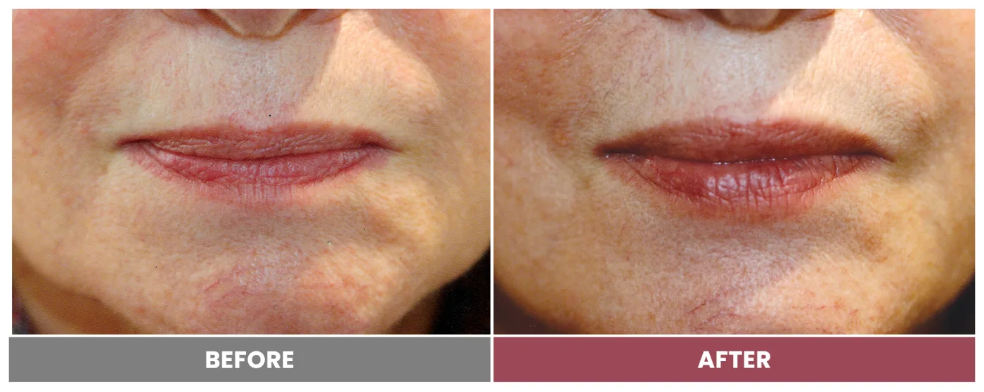 NEUROMODULATORS & DERMAL FILLERS - Case 28