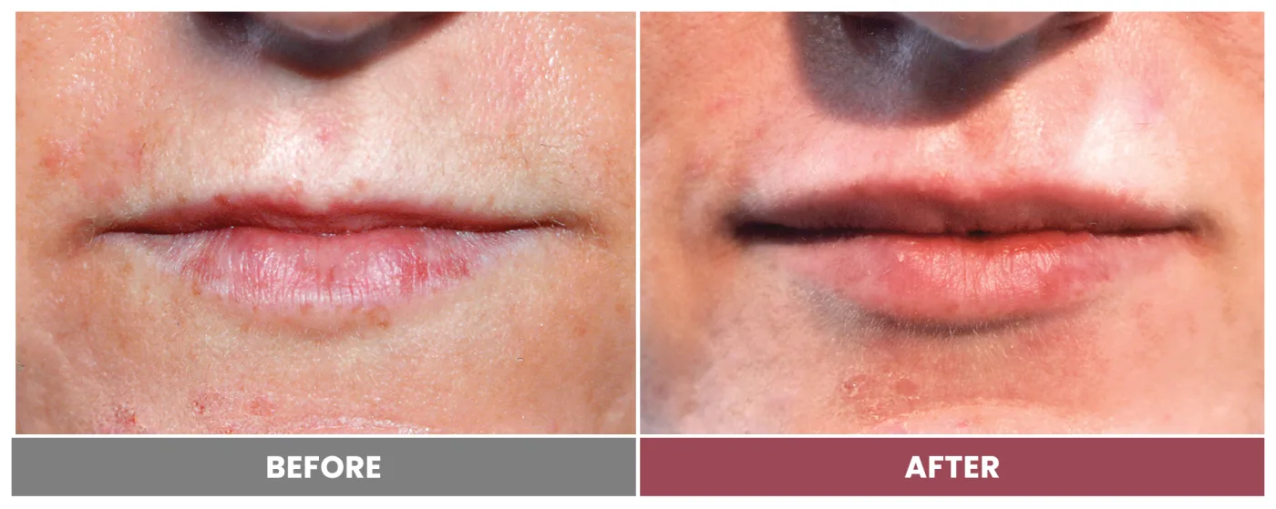 NEUROMODULATORS & DERMAL FILLERS - Case 29