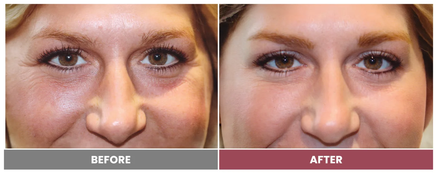 NEUROMODULATORS & DERMAL FILLERS - Case 3