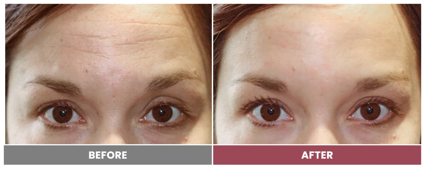 NEUROMODULATORS & DERMAL FILLERS - Case 7
