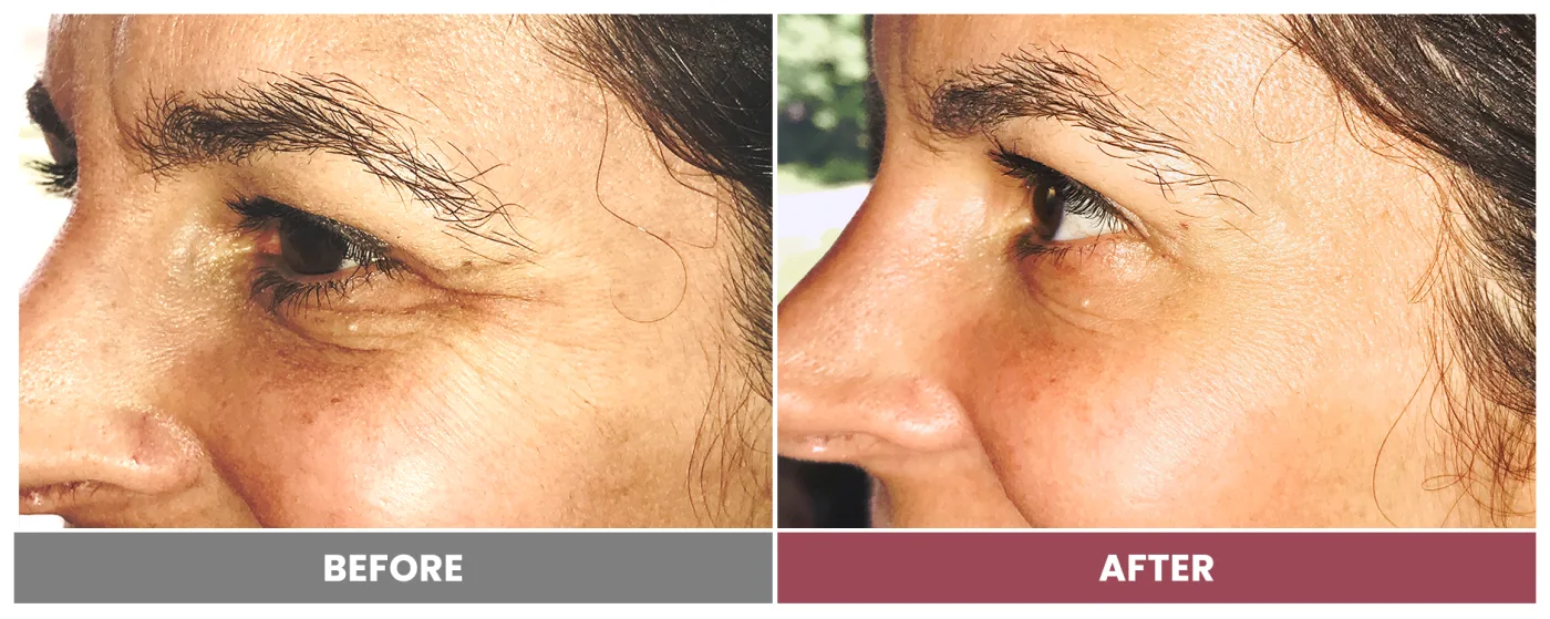 NEUROMODULATORS & DERMAL FILLERS - Case 9