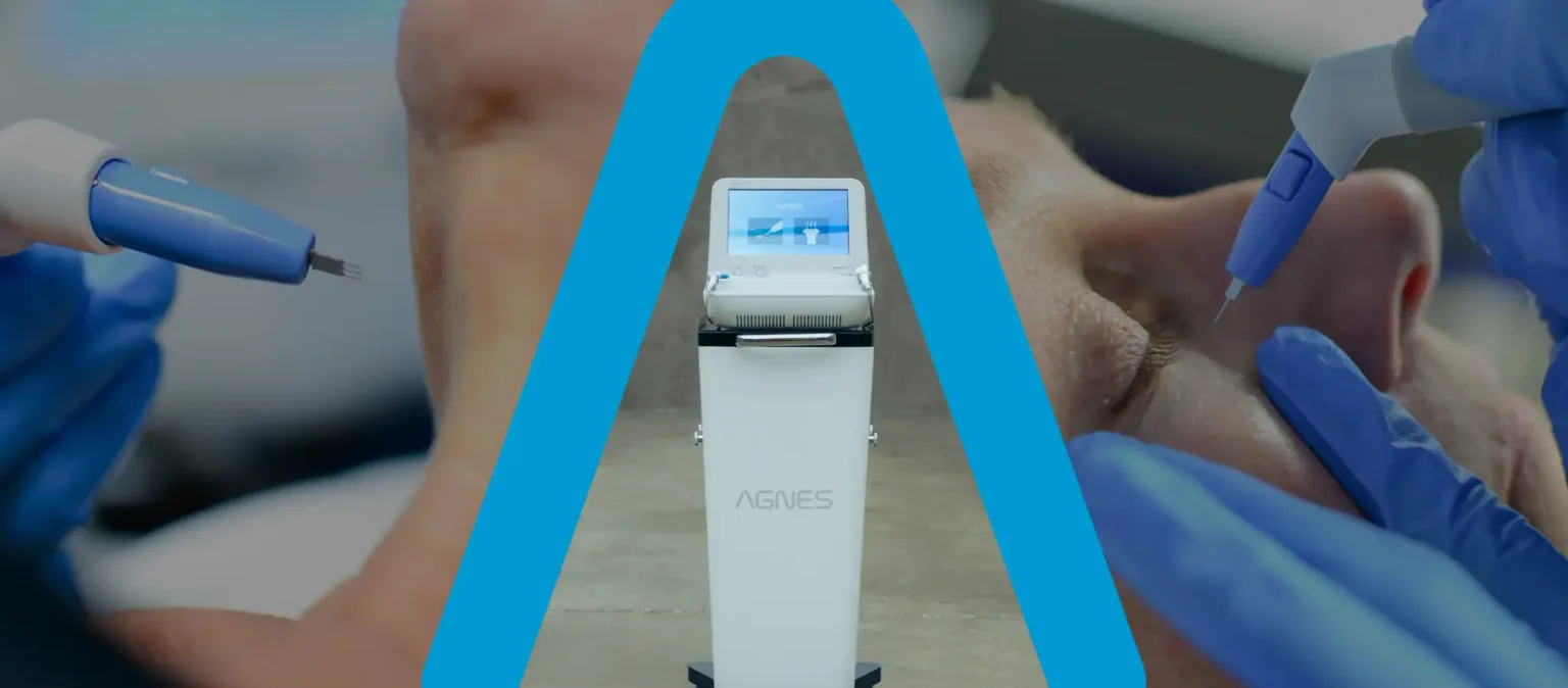 Agnes RF
